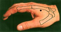 Right LI4 photo-diagram