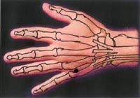 TW 3 located on right hand