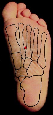 The red dot locates KD-1 on the bottom of the left foot